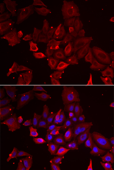 MYOT antibody