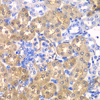 HPD antibody