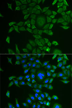 CCBL1 antibody