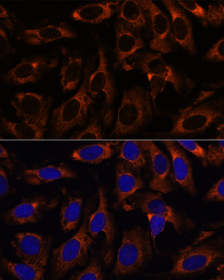 CCT3 antibody