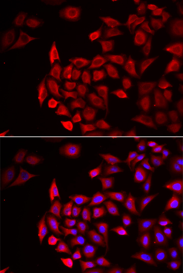 COCH antibody