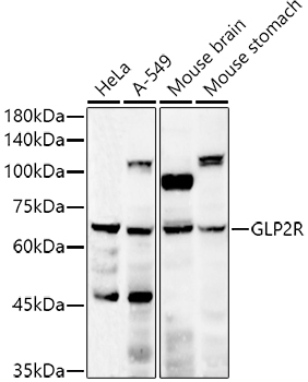 GLP2R antibody