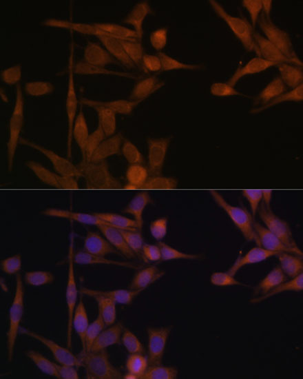 PPP2CA antibody