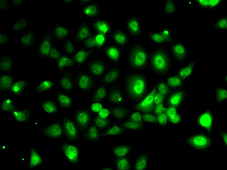 PPP2R1B antibody