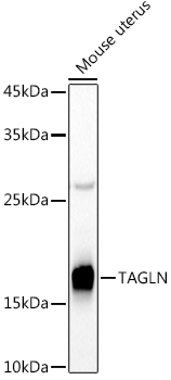TAGLN antibody