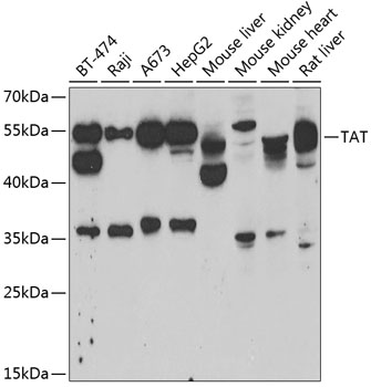 TAT antibody
