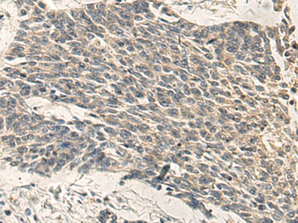 PRKCH antibody