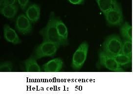 Anti-Zyxin Antibody