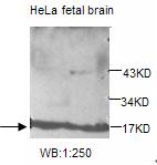 Anti-UBE2V2 Antibody