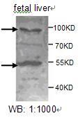 Anti-ADAMTS8 Antibody