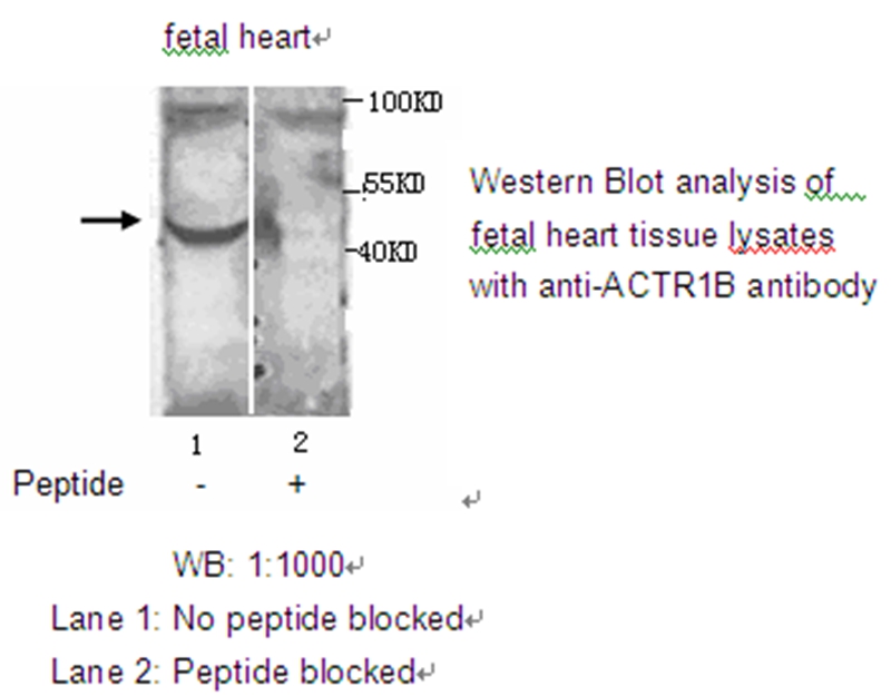 Anti-ACTR1B Antibody
