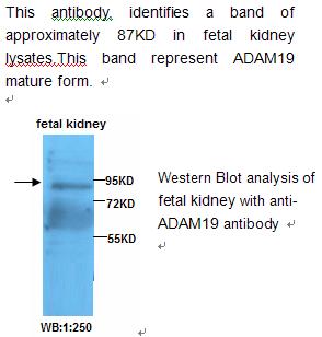 Anti-ADAM19 Antibody