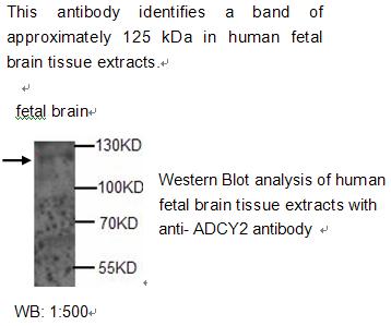 Anti-ADCY2 Antibody