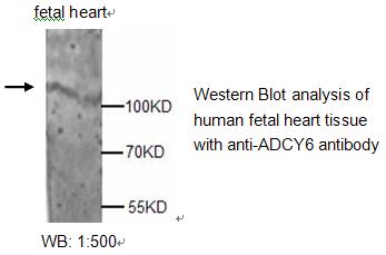 Anti-ADCY6 Antibody