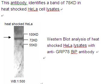 Anti-GRP78 Bip Antibody