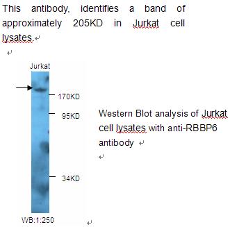 Anti-RBBP6 Antibody