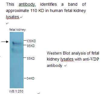 Anti-VDP Antibody