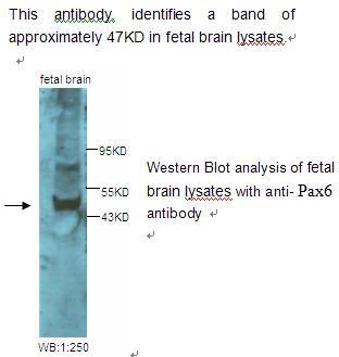 Anti-Pax6 Antibody