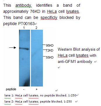 Anti-GFM1 Antibody