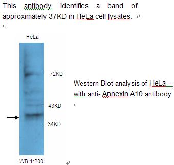 Anti-Annexin A10 Antibody
