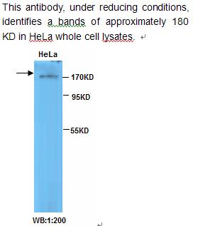Anti-TOP2B Antibody