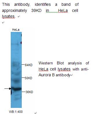 Anti-Aurora B Antibody