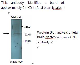 Anti-CNTF Antibody