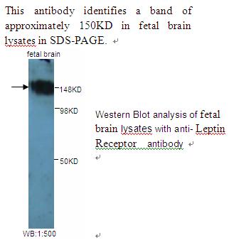 Anti-Leptin Receptor Antibody
