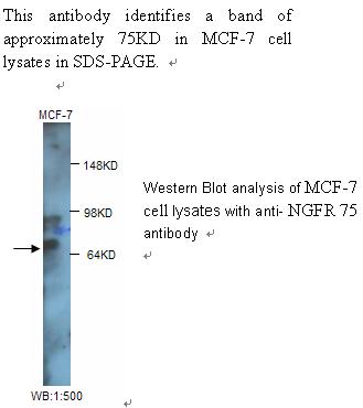 Anti-NGFR p75 Antibody