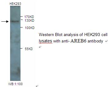 Anti-AREB6 Antibody