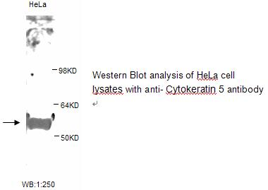 Anti-Cytokeratin 5 Antibody