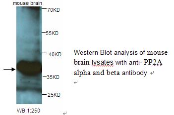 Anti-PP2A alpha and beta Antibody
