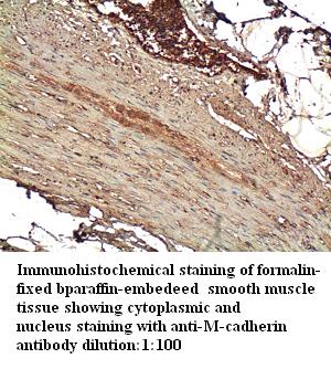 Anti-M-cadherin Antibody