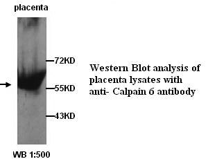 Anti-Calpain 6 Antibody