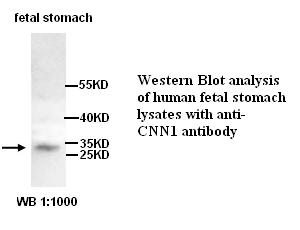 Anti-CNN1 Antibody