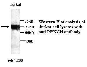 Anti-PRKCH Antibody