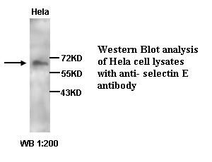 Anti- selectin E Antibody