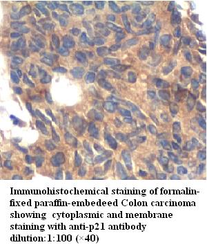 Anti- p21 Antibody