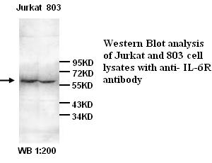 Anti-IL-6R Antibody