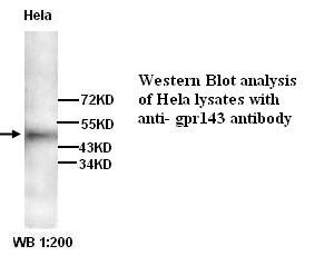 Anti-GPR143 Antibody