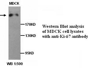 Anti-Ki-67 Antibody