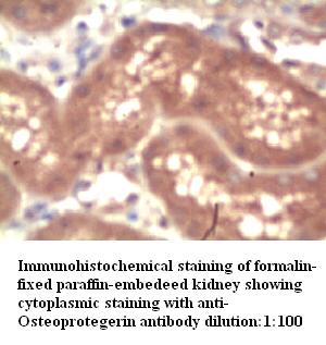 Anti-OPG Antibody