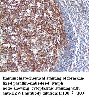 Anti-BZW1 Antibody