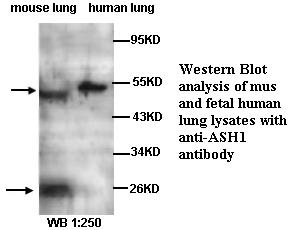 Anti-ASH1 Antibody