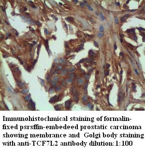 Anti-TCF7L2 Antibody