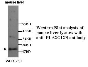 Anti-PLA2G12B Antibody