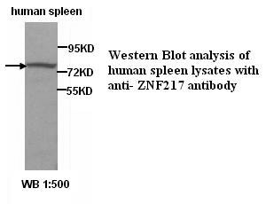 Anti-ZNF217 Antibody