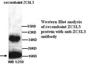 Anti-ZCSL3 Antibody