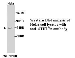 Anti-STK17A Antibody