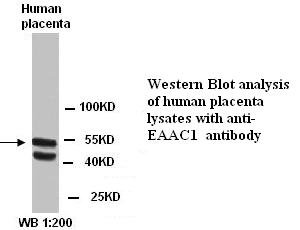 Anti-EAAC1 Antibody